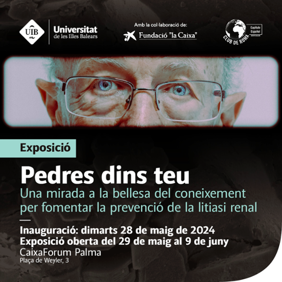 Pedres dins teu